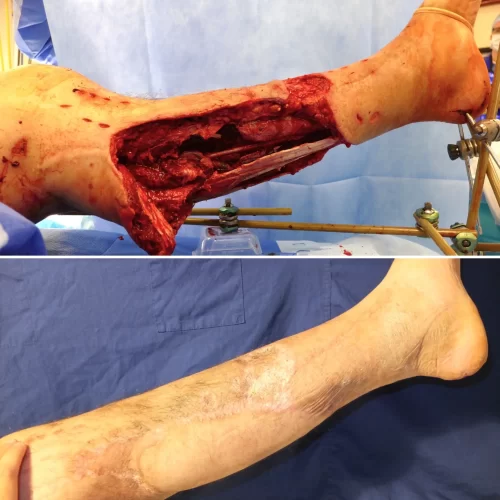 Dr Parviz Sadigh Surgeon(1)