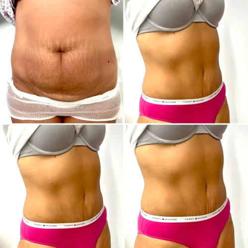 Dr Parviz Sadigh Surgeon(5)