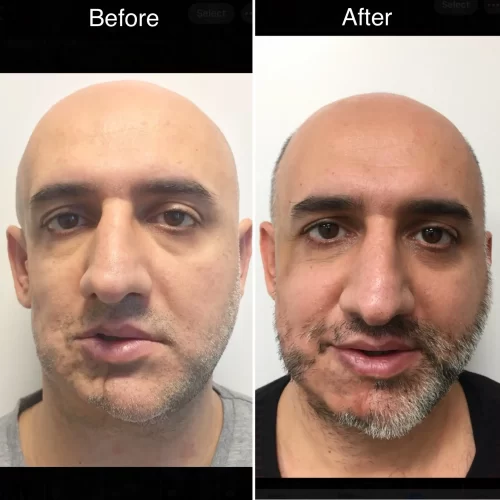 Dr Parviz Sadigh Surgeon(6)