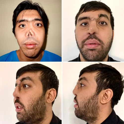 Dr Parviz Sadigh(2)