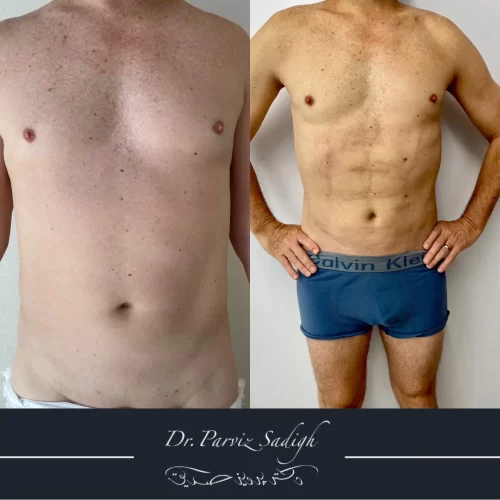 Dr Parviz Sadigh(3)