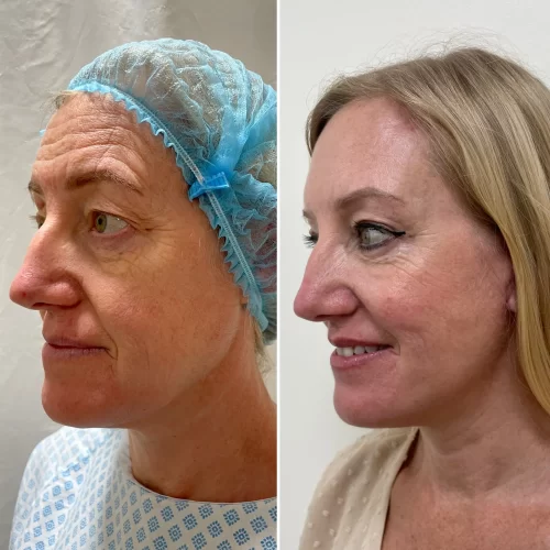 Plastic Surgeon(10)