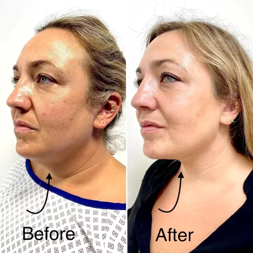 Plastic Surgeon(14)