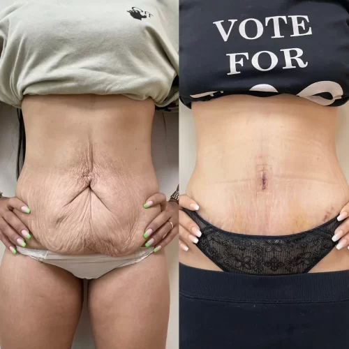 Plastic Surgeon(17)