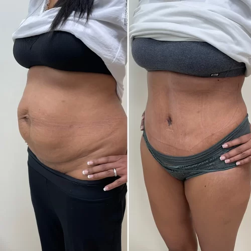 Plastic Surgeon(18)