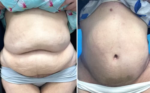Plastic Surgeon(5)